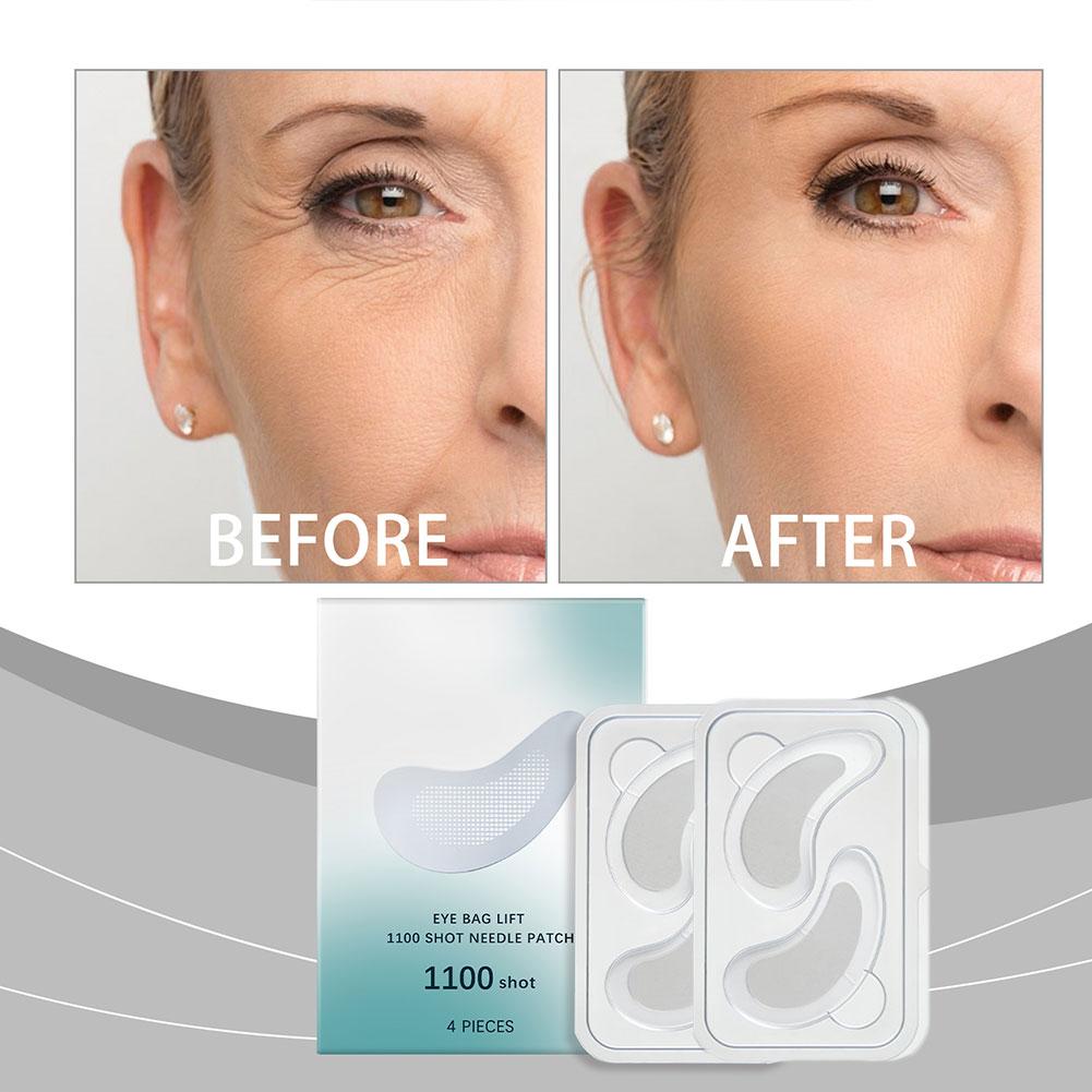 Hyaluronic Acid Microneedle Ey - Microneedle Patch Eye ulasan dan harga